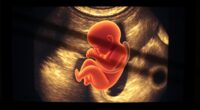 umbilical cord complications revealed